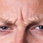 Etats-Unis - 4 personnes paralysées suite à des injections de faux botox Etats-Unis - 4 personnes paralysées suite à des injections de faux botox