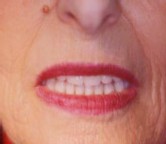Hausse de la demande de soins dentaires de la part des seniors britanniques Hausse de la demande de soins dentaires de la part des seniors britanniques