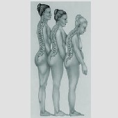 Ostéoporose : publication des dernières avancées importantes sur cette maladie osseuse Ostéoporose : publication des dernières avancées importantes sur cette maladie osseuse