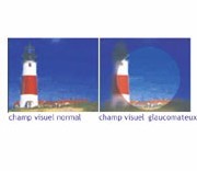 Glaucome : nouvelle campagne d’information à partir de demain Glaucome : nouvelle campagne d’information à partir de demain