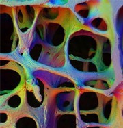Ostéoporose : une bonne nutrition est essentielle à la santé des os Ostéoporose : une bonne nutrition est essentielle à la santé des os