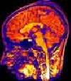 Espagne / Etats-Unis – Les antioxydants pourraient réparer les dégâts de l’alcool sur les neurones Espagne / Etats-Unis – Les antioxydants pourraient réparer les dégâts de l’alcool sur les neurones