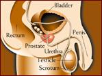 Australie – La masturbation réduirait les risques de cancer de la prostate Australie – La masturbation réduirait les risques de cancer de la prostate