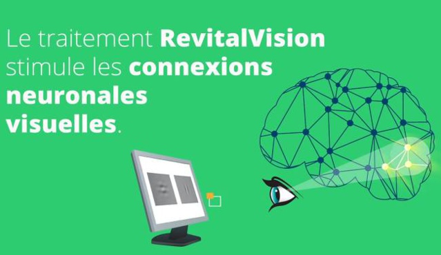 RevitalVision : mieux voir avec des "exercices physiques" pour les yeux !