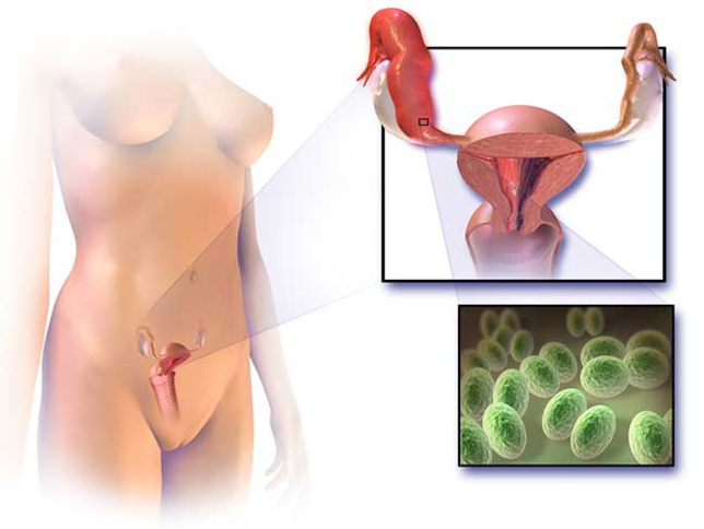 Cancer des ovaires : un cancer relativement peu fréquent mais à fort risque de récidive Cancer des ovaires : un cancer relativement peu fréquent mais à fort risque de récidive