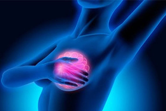 MammoRisk : pour un dépistage personnalisé du cancer du sein