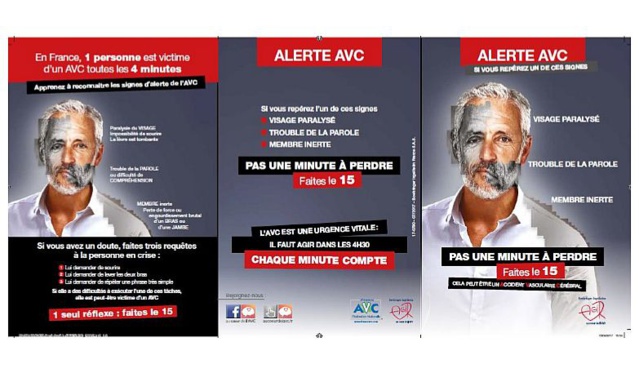 Alerte AVC : savoir faire face à l'urgence