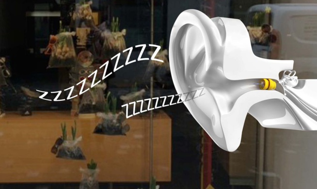 Phonak Lyric Phonak Lyric