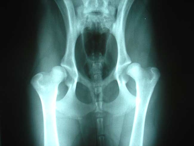 Arthrose et vertiges : l’ostéopathie comme solution durable sans effet secondaire