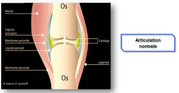 Articulation normale