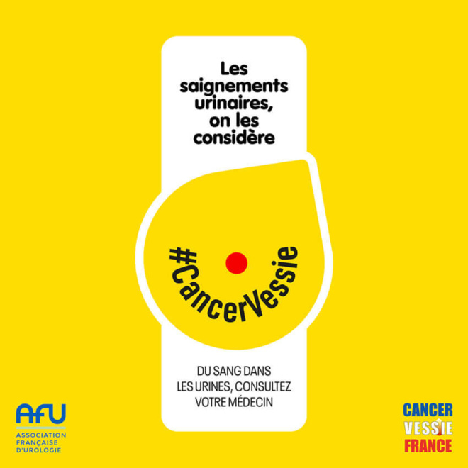 ©Cancer Vessie France ©Cancer Vessie France