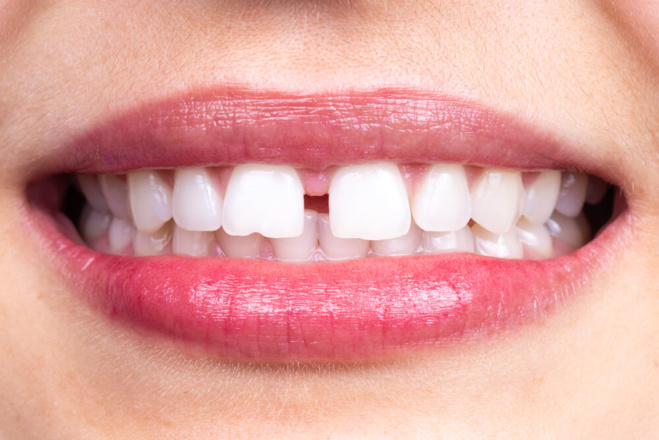 ©Shutterstock