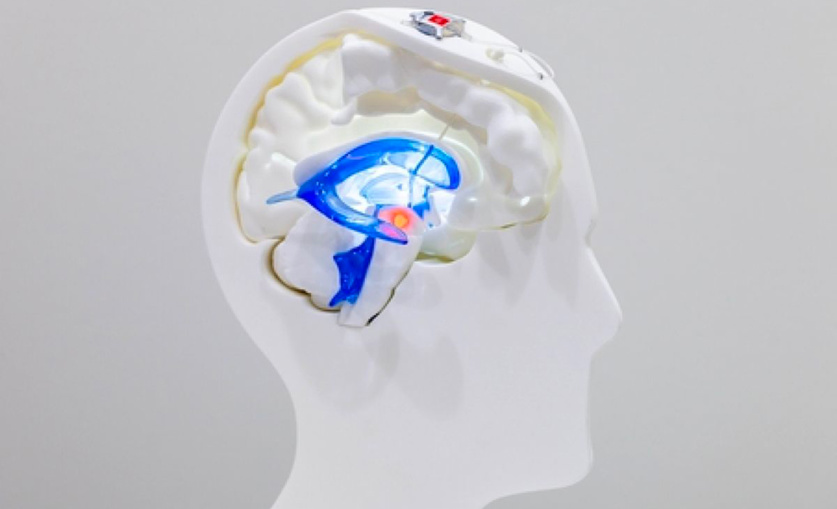 NIR ©CEA Grenoble NIR ©CEA Grenoble