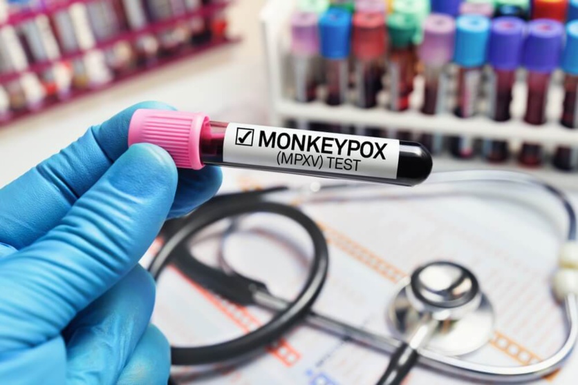 Test PCR pour la variole du singe ©Shutterstock Test PCR pour la variole du singe ©Shutterstock