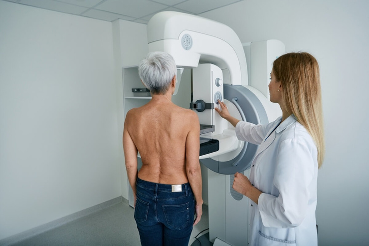 Femme senior réalisant une mamographie © Peakstock/Shutterstock