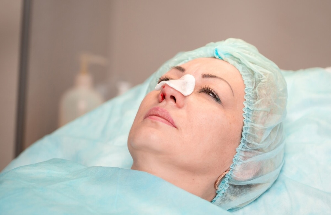Femme senior venant de subir une rhinoplastie douce © Vera Larina/Shutterstock