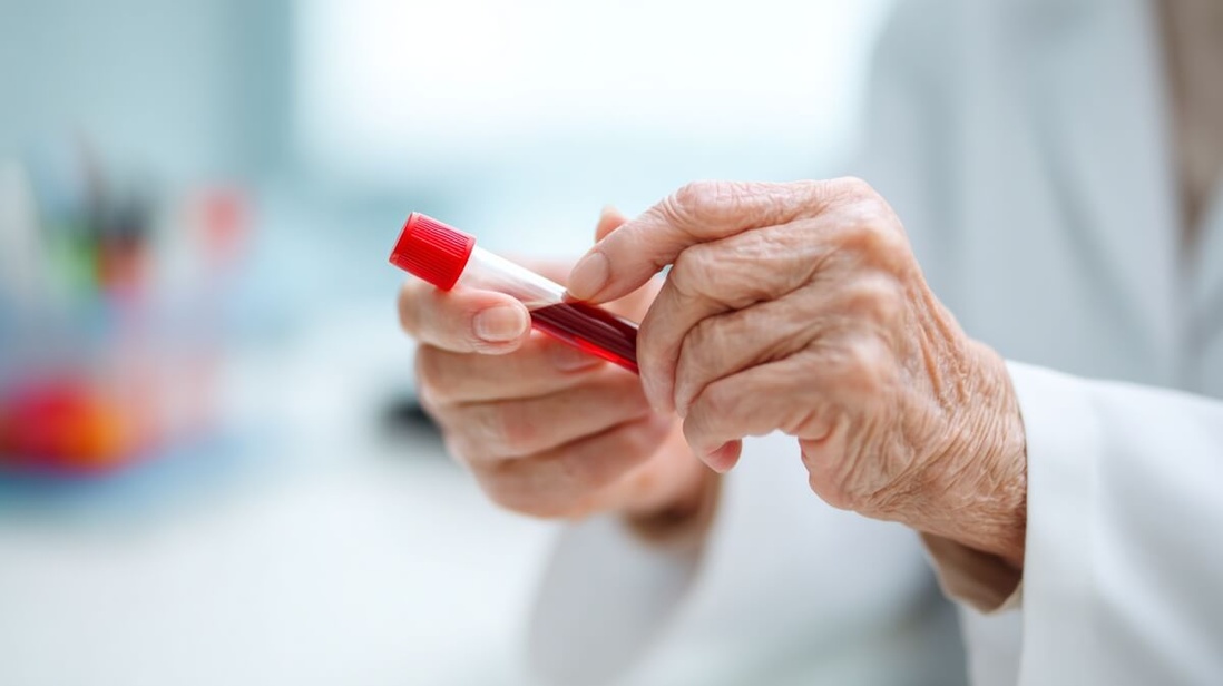 Prélèvement sanguin chez une personne âgée pour analyse des cellules souches © SeniorActu