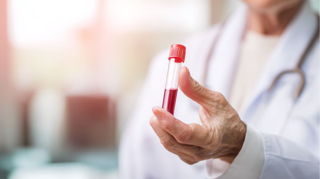 Tube de prélèvement sanguin tenu par des mains de personne âgée pour dépistage Parkinson © SeniorActu Tube de prélèvement sanguin tenu par des mains de personne âgée pour dépistage Parkinson © SeniorActu