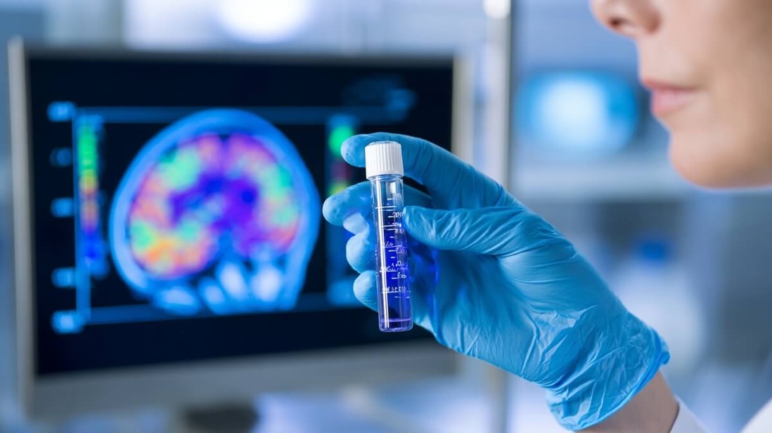 Laboratoire de recherche sur Alzheimer © SeniorActu Laboratoire de recherche sur Alzheimer © SeniorActu