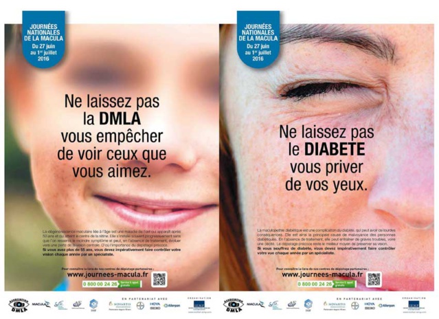 Ne laissez pas les maladies de la macula vous priver de vos yeux !