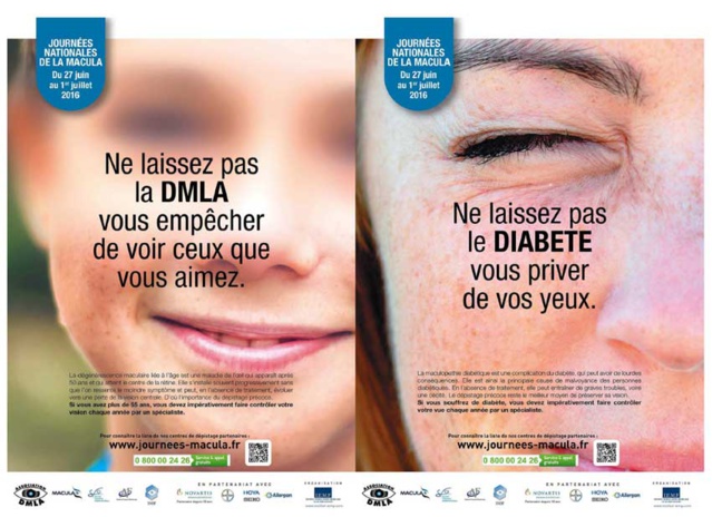 Ne laissez pas les maladies de la macula vous priver de vos yeux ! Ne laissez pas les maladies de la macula vous priver de vos yeux !