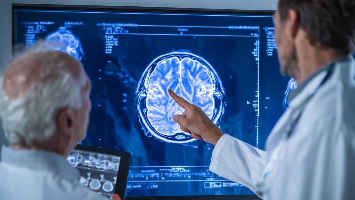 AVC : la menace cachée pour le cerveau