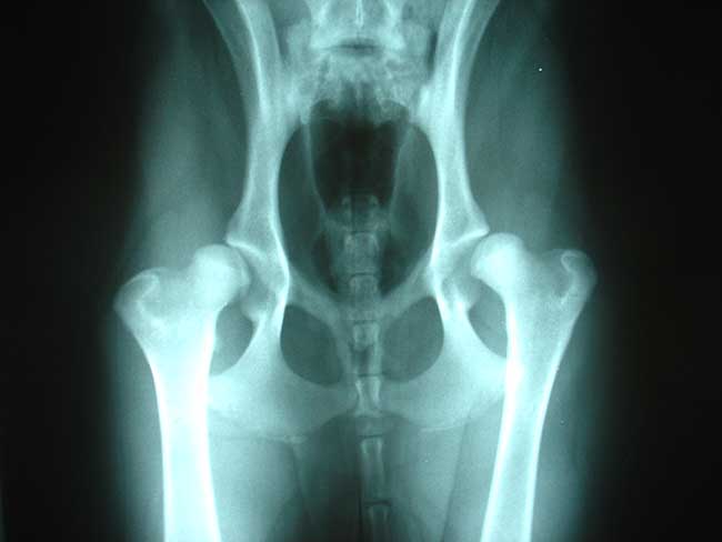 Arthrose et vertiges : l’ostéopathie comme solution durable sans effet secondaire