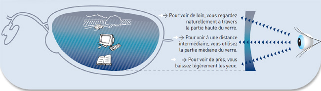 Presbytie : Varilux Series, des verres garantissant une adaptation immédiate