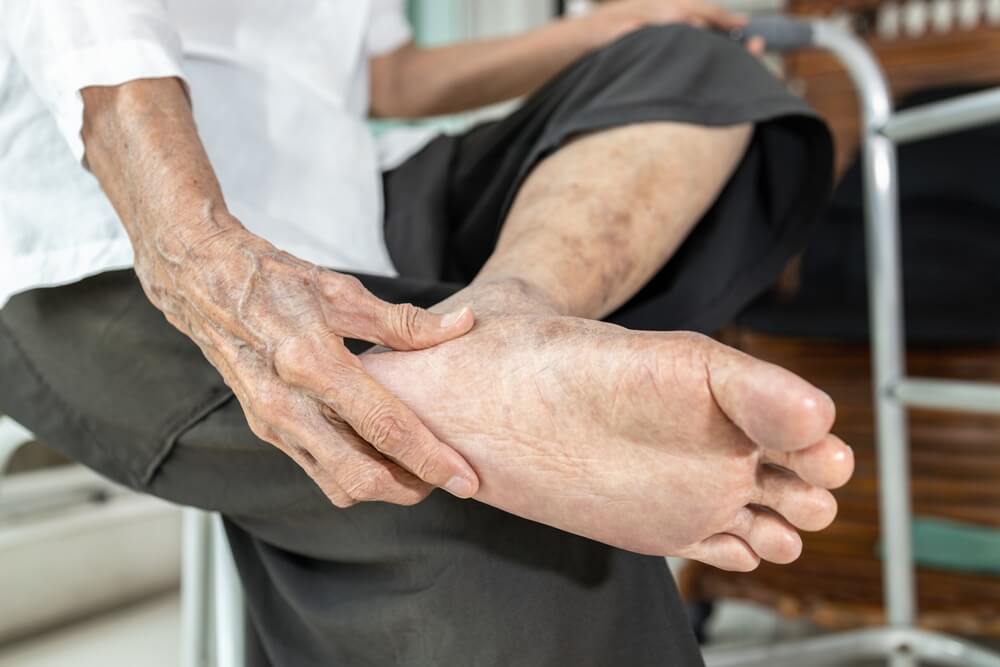 Personne âgée souffrant d'aponévrose plantaire ©Shutterstock