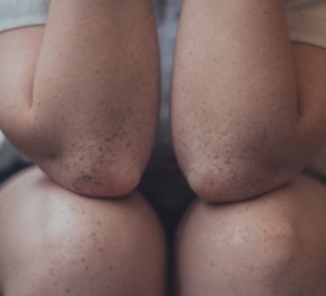 Salon des Thermalies 2023 : le bien-être articulaire Salon des Thermalies 2023 : le bien-être articulaire