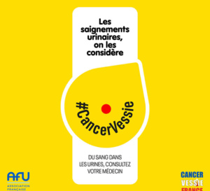 Cancer de la vessie : aussi méconnu que dévastateur