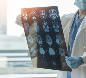 Le point sur les maladies neuro-dégénératives : 2% de la population française est touchée !