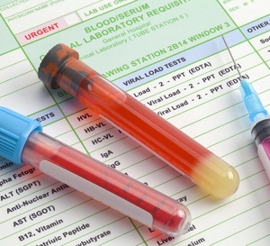 Cancers : les biomarqueurs circulants, un espoir sur tous les fronts