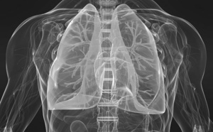 480 millions de personnes atteintes de la BPCO dans le monde !