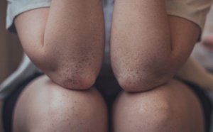 Salon des Thermalies 2023 : le bien-être articulaire