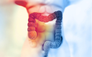 Cancer colorectal : nouvelle campagne d'information à destination des 50-74 ans