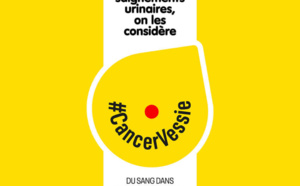 Cancer de la vessie : aussi méconnu que dévastateur