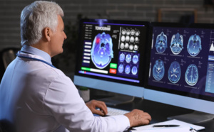 "Maintain Your Brain" : une étude visant à réduire les risques de développer Alzheimer en Australie