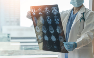 Le point sur les maladies neuro-dégénératives : 2% de la population française est touchée !
