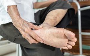 RheelaxX : une semelle contre l'aponévrosite plantaire du talon