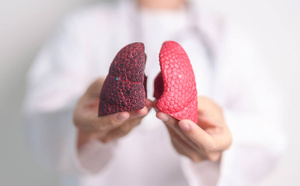 Ensemble Nous Poumons : mobilisation en faveur du dépistage individuel du cancer du poumon en France