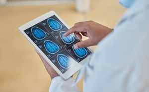 Parkinson : une altération du suivi avec le neurologue avec le temps
