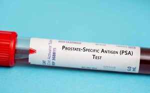 Cancer de la prostate : un traitement plus ciblé pourrait améliorer la prise en charge des récidives