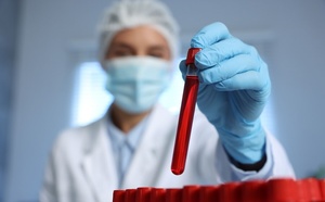 Rajeunir le sang : des chercheurs ont réussi à inverser le vieillissement cellulaire !