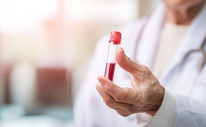 Parkinson : un test sanguin pourrait détecter la maladie 10 ans plus tôt