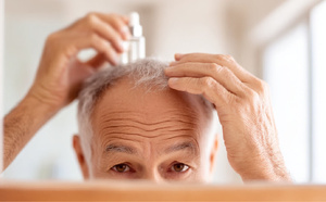 Calvitie après 50 ans : ce nouveau traitement qui suscite un espoir inédit