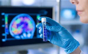Alzheimer : pourquoi cette piste thérapeutique intrigue tant les chercheurs