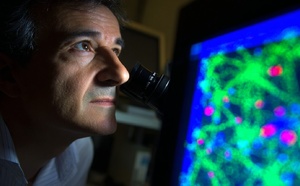 Alzheimer : ces cellules méconnues pourraient expliquer la progression de la maladie