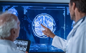 AVC : un seul suffit à faire basculer votre cerveau dans la démence