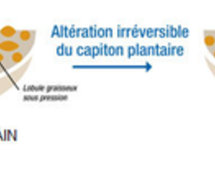 Attention, il y capitons et capiton !